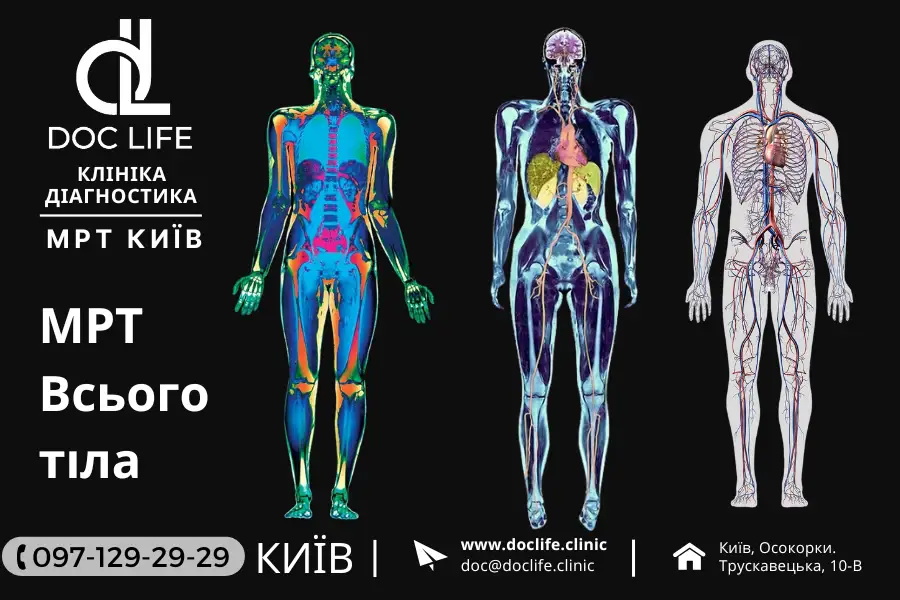 Doc Life МРТ та КТ центр Осокорки - М24 МРТ центр - ТОП-5 Центрів МРТ у Києві: Де отримати якісну діагностику Doc Life МРТ та КТ центр Осокорки - М24 МРТ центр - ТОП-5 Центрів МРТ у Києві: Де отримати якісну діагностику