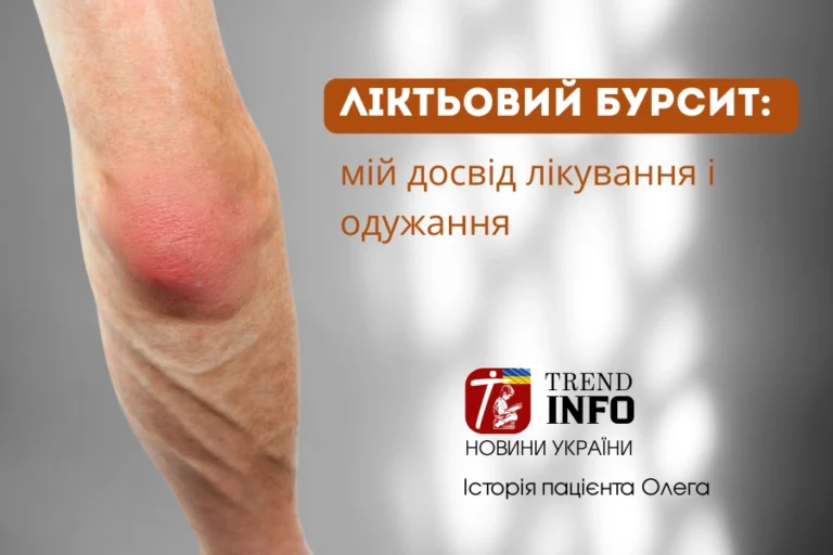 Ліктьовий бурсит історія лікування пацієнта 1