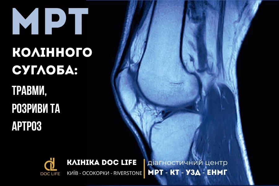 мрт колінного суглоба 3